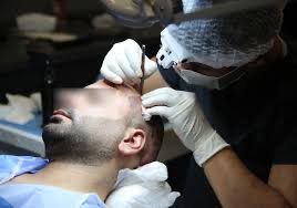 Global Health Hair clinic in Istanbul 2